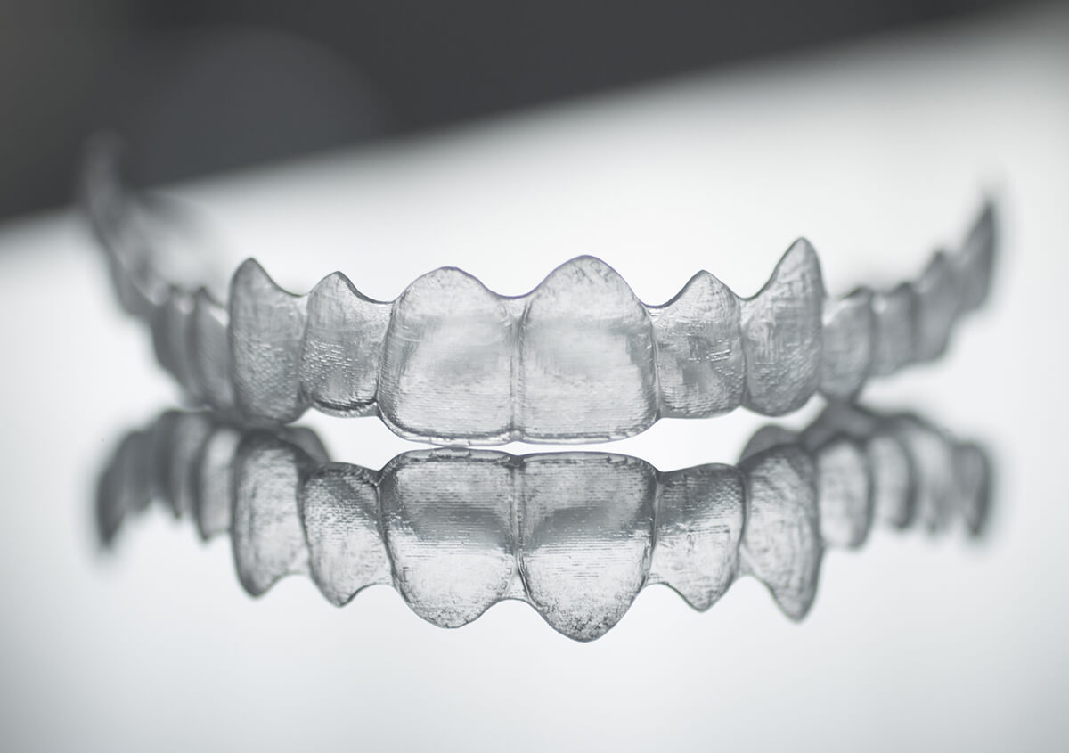 What Are The Results and Benefits of Clear Braces in Mississauga Area