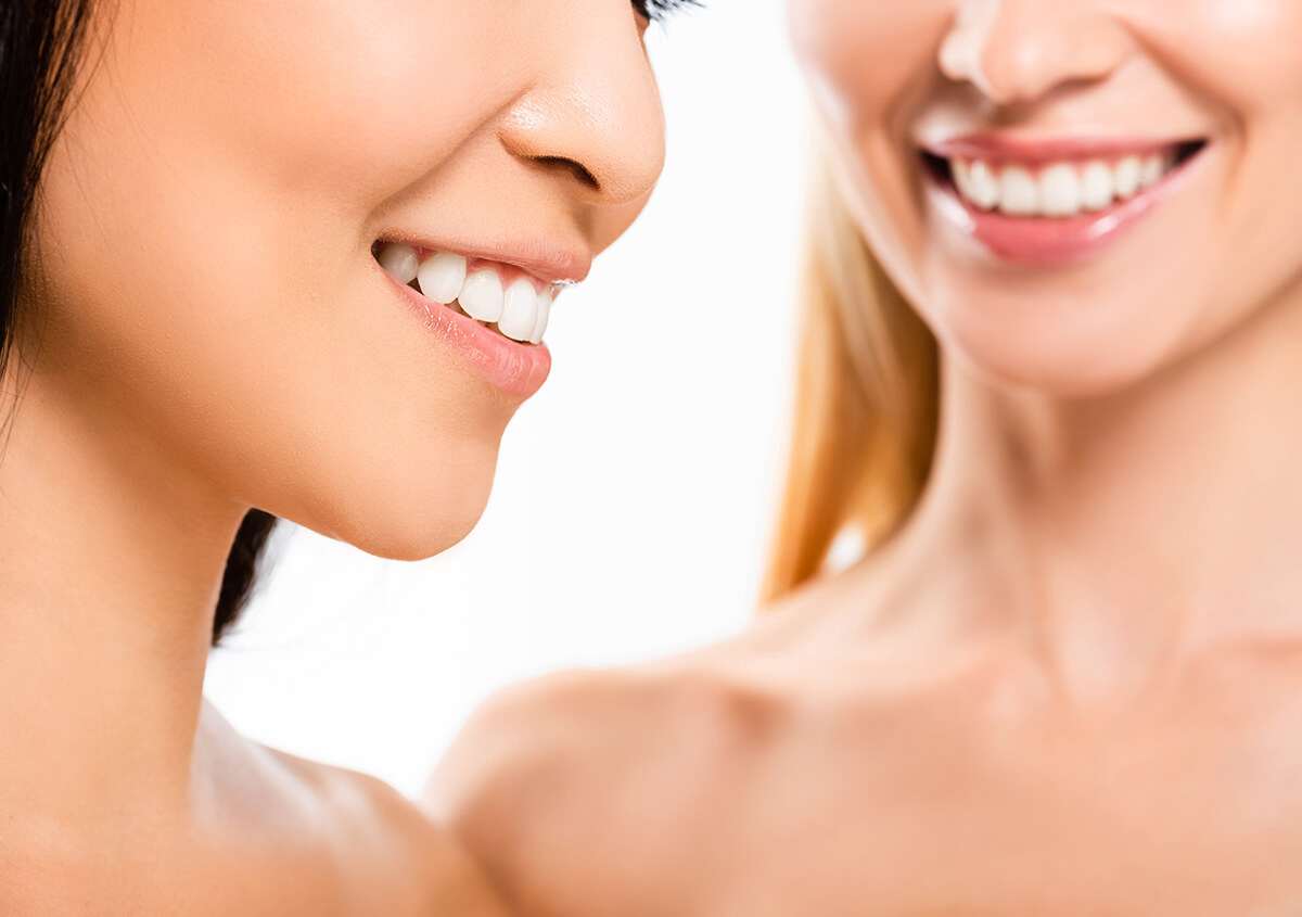 Cosmetic Dental Bonding at Sherway Dentistry in Etobicoke ON Area