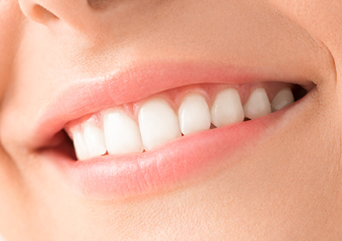 Build a Better Smile with Cosmetic Dental Services in Etobicoke, ON Area