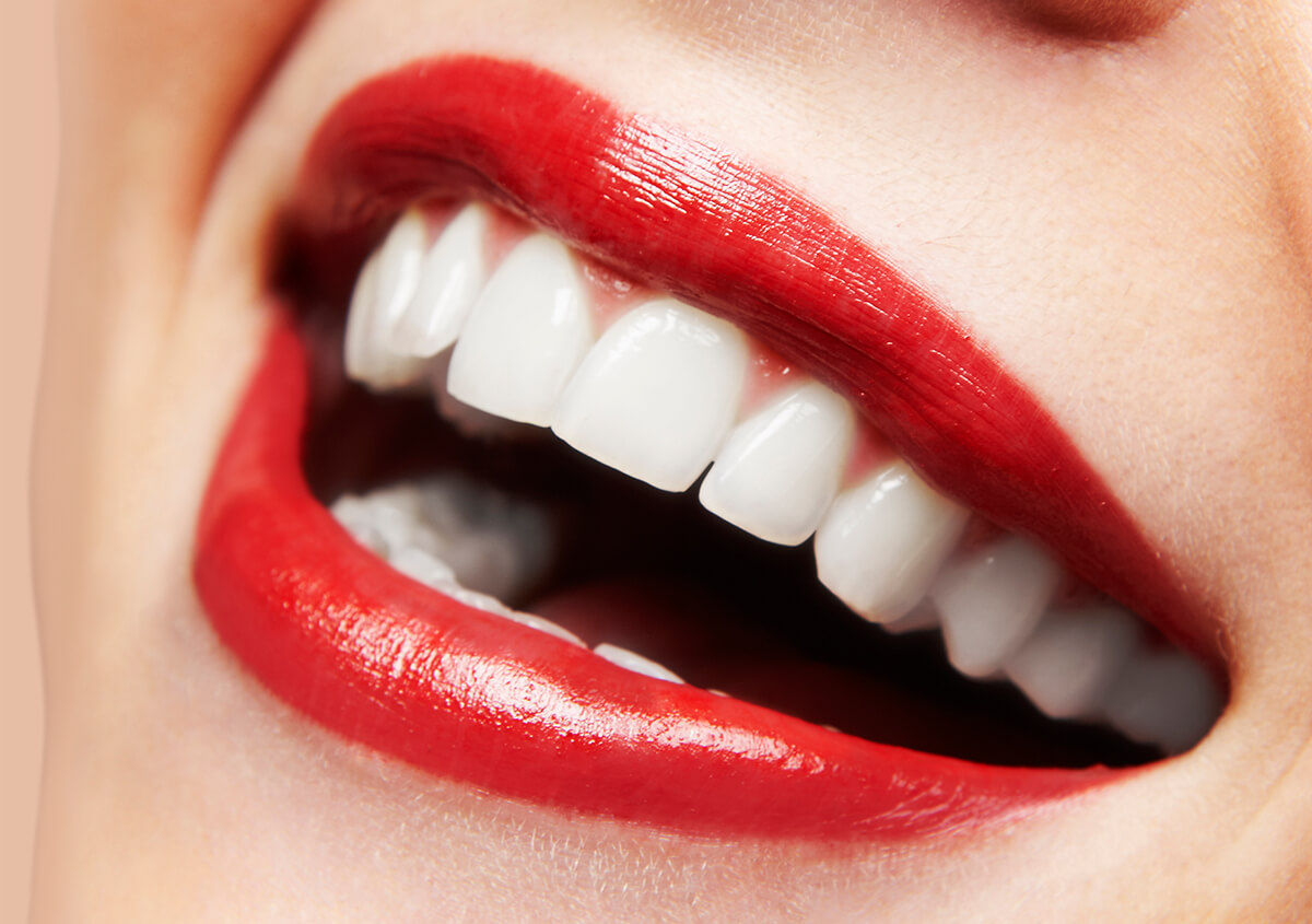 Comparing Options for Cosmetic Dental Veneers in Etobicoke ON Area