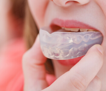 Custom Fit Sports Mouthguards in Etobicoke Area