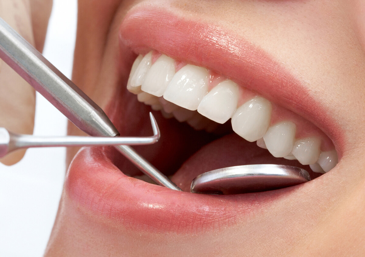 Gentle Dental Cleanings for Healthy Smiles in Etobicoke, ON Area