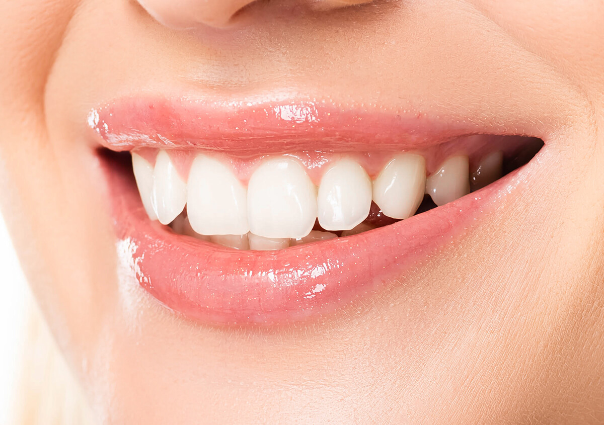 Trust the Health and Appearance of Your Teeth to the Dental Professionals: Whitening Options in Etobicoke Area