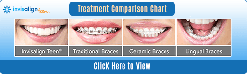 Invisalign Vs Braces Chart